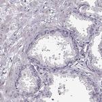 FSH beta Antibody in Immunohistochemistry (Paraffin) (IHC (P))