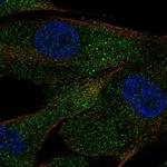 ACE Polyclonal Antibody