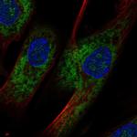 OMD Polyclonal Antibody