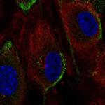 PIK3CG Polyclonal Antibody