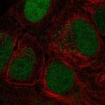 FCP1 Antibody in Immunocytochemistry (ICC/IF)