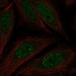 MKNK2 Polyclonal Antibody