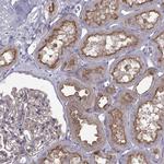 Arylsulfatase E Polyclonal Antibody