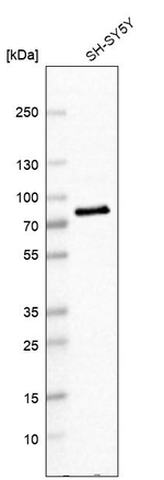 Dopamine beta Hydroxylase Antibody in Western Blot (WB)