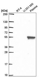MMP19 Antibody in Western Blot (WB)