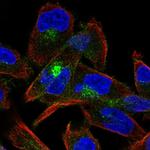 M-cadherin Polyclonal Antibody