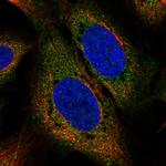 USP15 Polyclonal Antibody