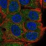 TAB2 Polyclonal Antibody