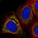 PAPSS2 Polyclonal Antibody