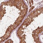 ETEA Polyclonal Antibody