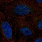 CSB Polyclonal Antibody