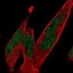 TCF7L1 Polyclonal Antibody