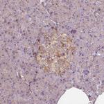 GPRC5D Antibody in Immunohistochemistry (Paraffin) (IHC (P))