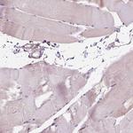 GPRC5D Antibody in Immunohistochemistry (Paraffin) (IHC (P))