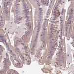 GPRC5D Antibody in Immunohistochemistry (Paraffin) (IHC (P))