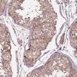 GPRC5D Polyclonal Antibody