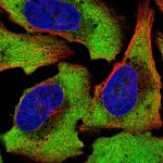 ATXN2L Polyclonal Antibody