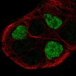 GPR161 Antibody in Immunocytochemistry (ICC/IF)
