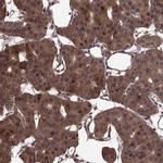 FBXW11 Polyclonal Antibody