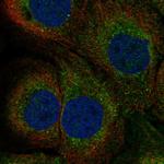 TAP1 Polyclonal Antibody