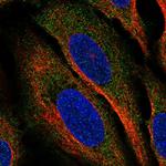 CLEC2A Polyclonal Antibody