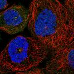 SDCCAG8 Polyclonal Antibody