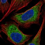 CCDC47 Polyclonal Antibody