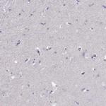 TBX19 Antibody in Immunohistochemistry (Paraffin) (IHC (P))