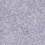 TBX19 Polyclonal Antibody