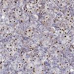 TBX19 Antibody in Immunohistochemistry (Paraffin) (IHC (P))