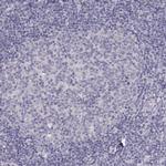 TBX19 Antibody in Immunohistochemistry (Paraffin) (IHC (P))