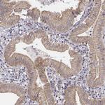 SCARF1 Polyclonal Antibody
