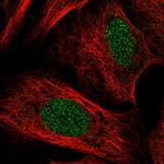 TOX Polyclonal Antibody