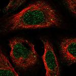 CCRD6 Polyclonal Antibody