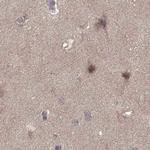 PLEKHG3 Antibody in Immunohistochemistry (Paraffin) (IHC (P))