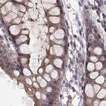 PLEKHG3 Antibody in Immunohistochemistry (Paraffin) (IHC (P))