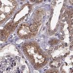 PLEKHG3 Antibody in Immunohistochemistry (Paraffin) (IHC (P))