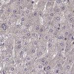 PLEKHG3 Antibody in Immunohistochemistry (Paraffin) (IHC (P))