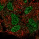 HOXB5 Polyclonal Antibody