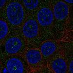 TMEM217 Polyclonal Antibody