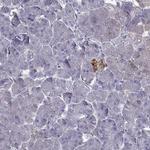 SCG5 Antibody in Immunohistochemistry (Paraffin) (IHC (P))