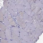 SCG5 Antibody in Immunohistochemistry (Paraffin) (IHC (P))