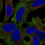 LINGO1 Polyclonal Antibody