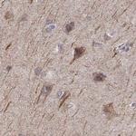 PLEKHG3 Antibody in Immunohistochemistry (Paraffin) (IHC (P))