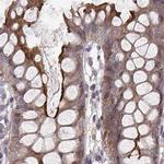 PLEKHG3 Antibody in Immunohistochemistry (Paraffin) (IHC (P))