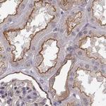 PLEKHG3 Antibody in Immunohistochemistry (Paraffin) (IHC (P))