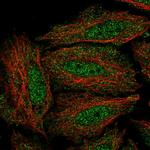 DYRK3 Polyclonal Antibody