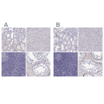 MAGEB2 Antibody in Immunohistochemistry (Paraffin) (IHC (P))