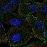 PPP1R9A Polyclonal Antibody