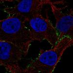 PDE4A Polyclonal Antibody